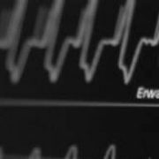 ekg